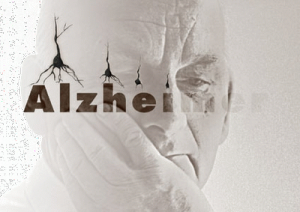 Alzheimer