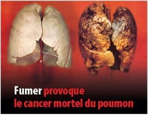 tabac cancer
